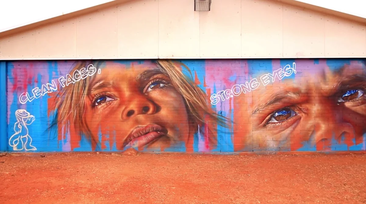 a-historic-victory-australia-eliminates-trachoma-as-a-public-health-problem-1