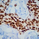a-new-chapter-for-protacs-rigel-pharmaceuticals-acquires-veppanu-in-landmark-deal-with-arvinas-and-pfizer