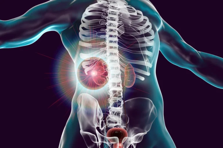 a-new-frontier-in-oncology-the-impact-of-nices-approval-of-cryoablation-for-kidney-cancer