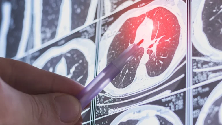 a-new-frontier-in-pulmonary-care-oorja-bio-emerges-with-30m-to-tackle-lung-fibrosis