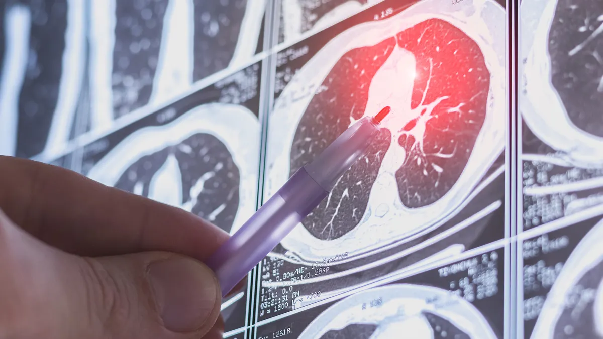 a-new-frontier-in-pulmonary-care-oorja-bio-emerges-with-30m-to-tackle-lung-fibrosis
