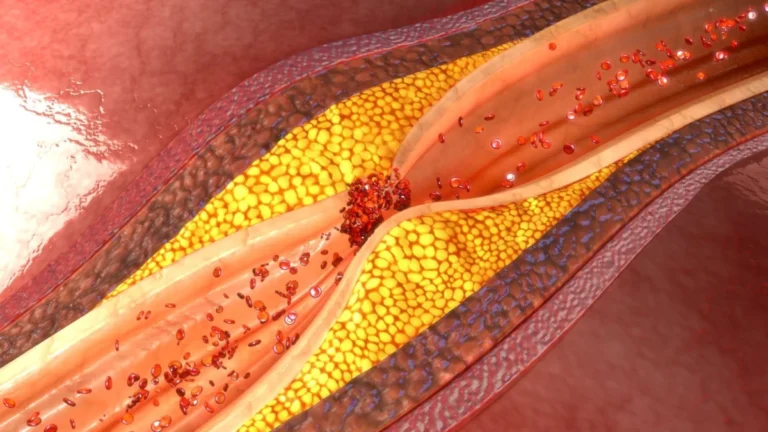cagent-vascular-secures-41m-series-d-to-advance-dual-modality-ivl-platform-as-cardiovascular-market-heats-up