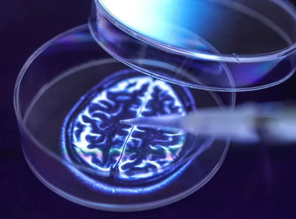 clinical-setback-biogen-and-denalis-parkinsons-drug-fails-key-phase-2b-trial