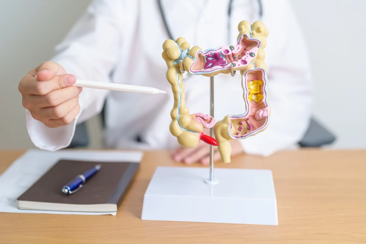 colorectal-cancer-cases-poised-for-rise-in-the-us-innovations-in-screening-offer-hope-for-early-detection