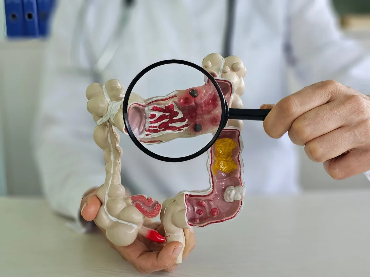 emerging-pesticide-link-to-early-onset-colorectal-cancer-sparks-concern-and-calls-for-further-research