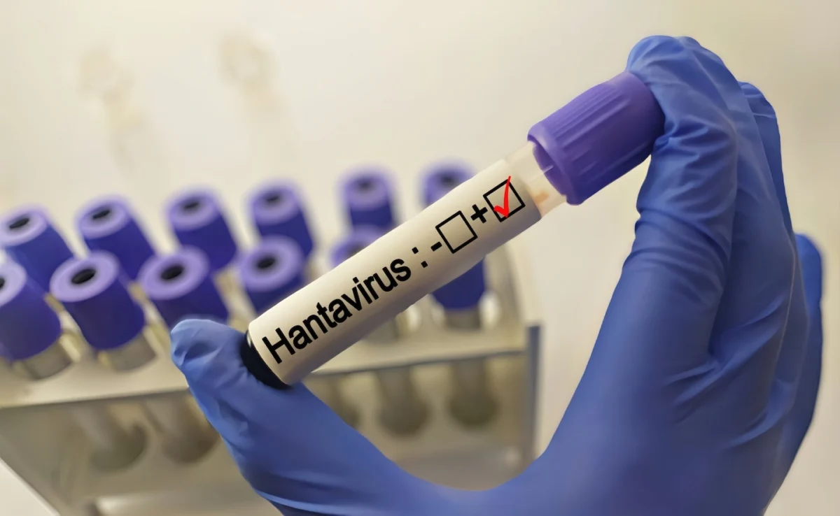 hantavirus-outbreak-on-mv-hondius-global-health-authorities-mobilize-as-cruise-ship-docks-in-canary-islands