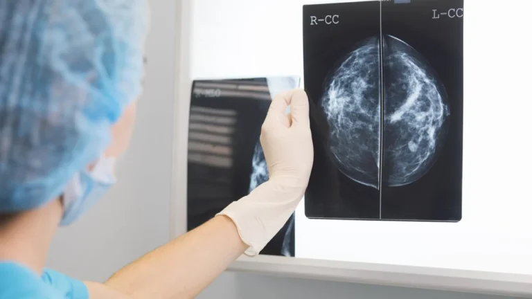 landmark-breast-cancer-trials-phergain-and-phergain-2-offer-hope-for-chemotherapy-de-escalation