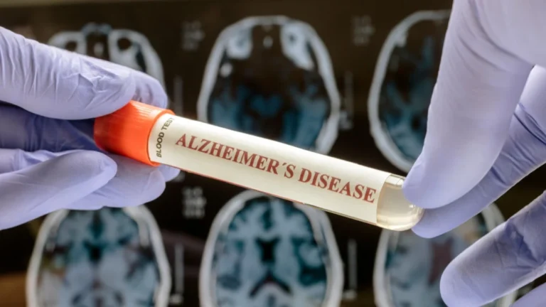 roche-secures-ce-mark-for-breakthrough-elecsys-ptau217-blood-test-a-new-era-in-alzheimers-diagnostics