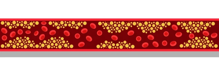 tryngolza-shows-significant-promise-in-severe-hypertriglyceridemia-potentially-challenging-market-leader-redemplo
