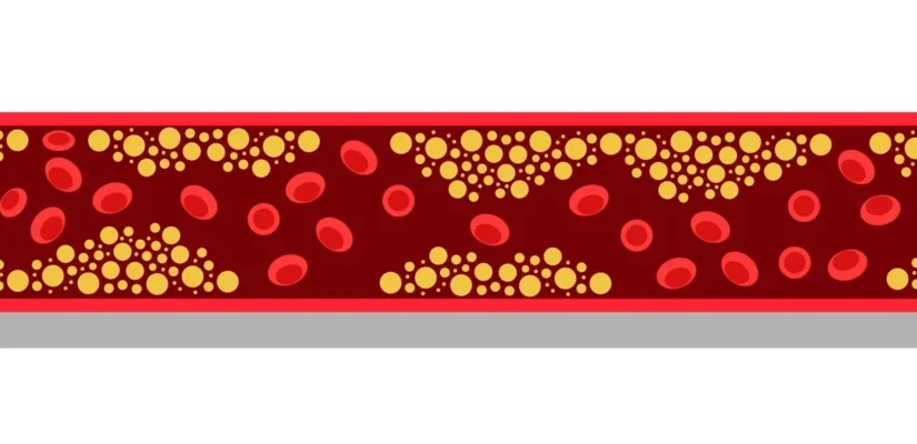 tryngolza-shows-significant-promise-in-severe-hypertriglyceridemia-potentially-challenging-market-leader-redemplo