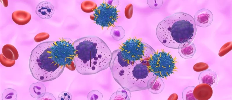 a-new-frontier-in-hematology-teclistamab-redefines-treatment-for-high-risk-smoldering-multiple-myeloma