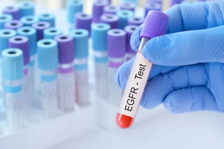 accelerating-hope-how-biomarkers-are-revolutionizing-nephrology-drug-development
