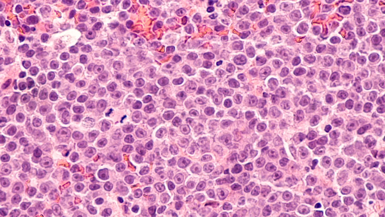 adc-therapeutics-faces-market-reckoning-as-clinical-success-is-overshadowed-by-safety-concerns