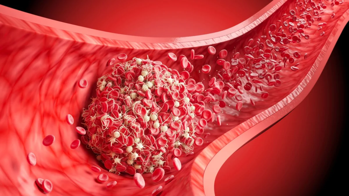 advancing-stroke-care-penumbra-receives-fda-clearance-for-thunderbolt-thrombectomy-platform