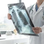 ai-driven-radiology-aidocs-first-read-receives-fda-breakthrough-designation-to-combat-imaging-backlogs