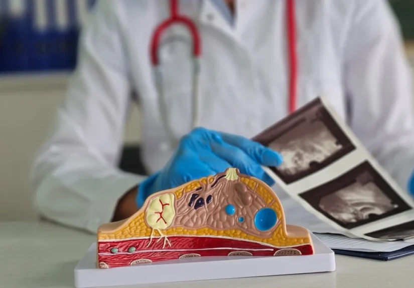 bcal-diagnostics-advances-liquid-biopsy-frontier-new-breastest-monitor-targets-post-treatment-recurrence