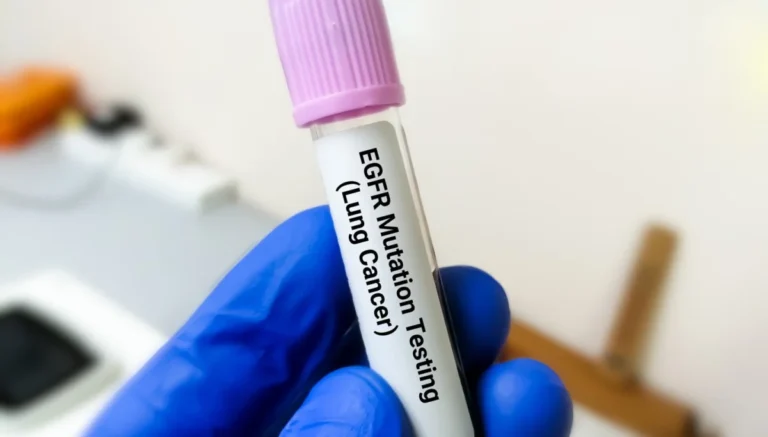 breakthrough-trial-launched-to-combat-resistance-in-egfr-mutant-lung-cancer