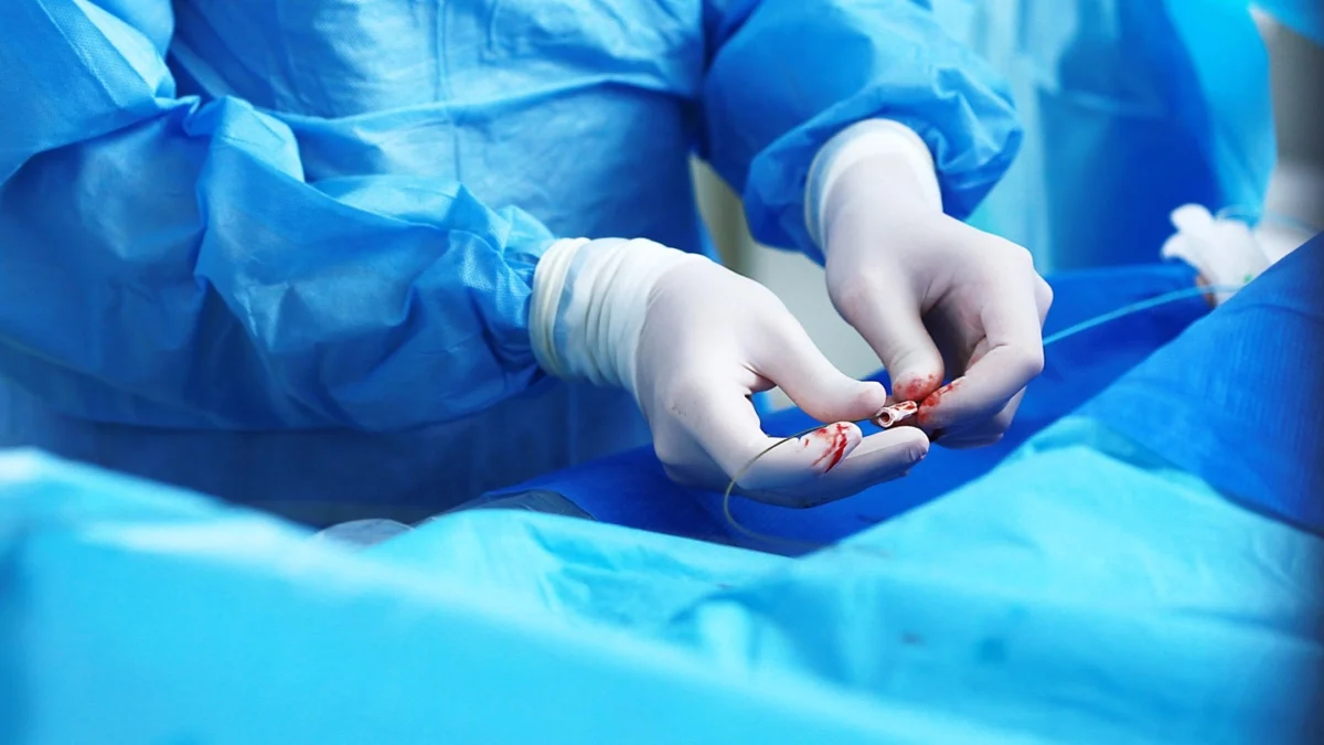 cerevasc-reaches-pivotal-milestone-stride-trial-enrolment-concludes-for-innovative-eshunt-system