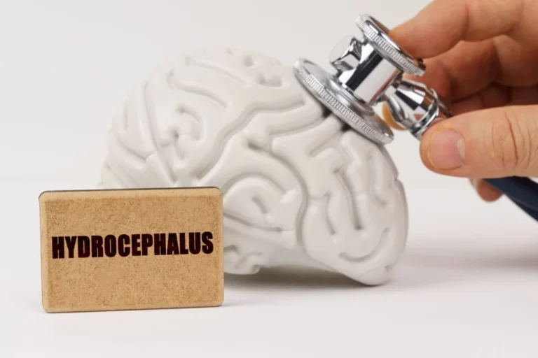 cerevasc-secures-85m-series-c-funding-to-advance-minimally-invasive-hydrocephalus-treatment