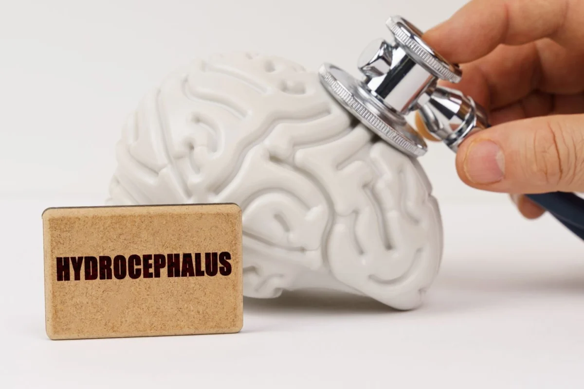 cerevasc-secures-85m-series-c-funding-to-advance-minimally-invasive-hydrocephalus-treatment