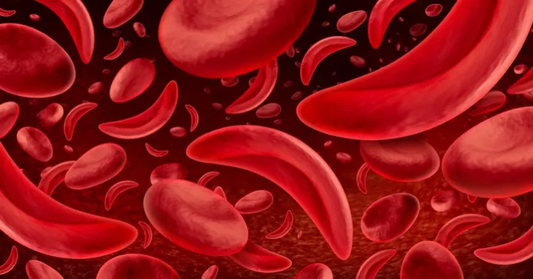 crossroads-for-fulcrum-therapeutics-strategic-review-initiated-following-fda-mandated-halt-to-sickle-cell-program