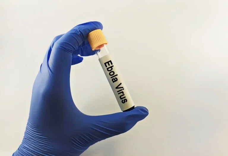 historic-collaboration-launched-to-combat-bundibugyo-ebola-outbreak-ema-and-ama-forge-unprecedented-partnership