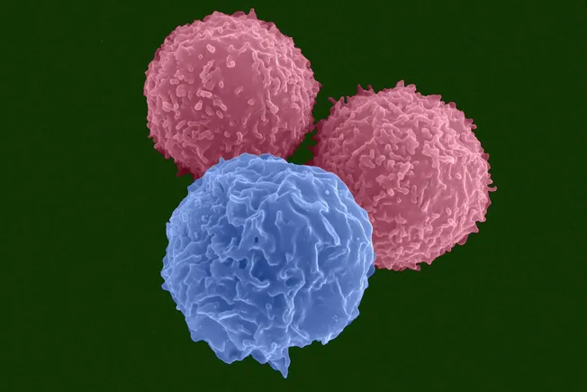 jazz-pharmaceuticals-and-abcellera-forge-strategic-alliance-to-tackle-solid-tumors-with-multispecific-antibodies