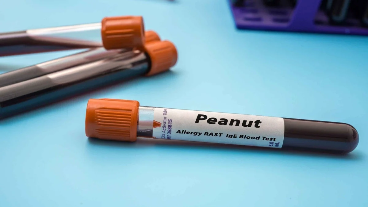 landmark-clinical-trial-launches-for-novel-peanut-allergy-immunotherapy