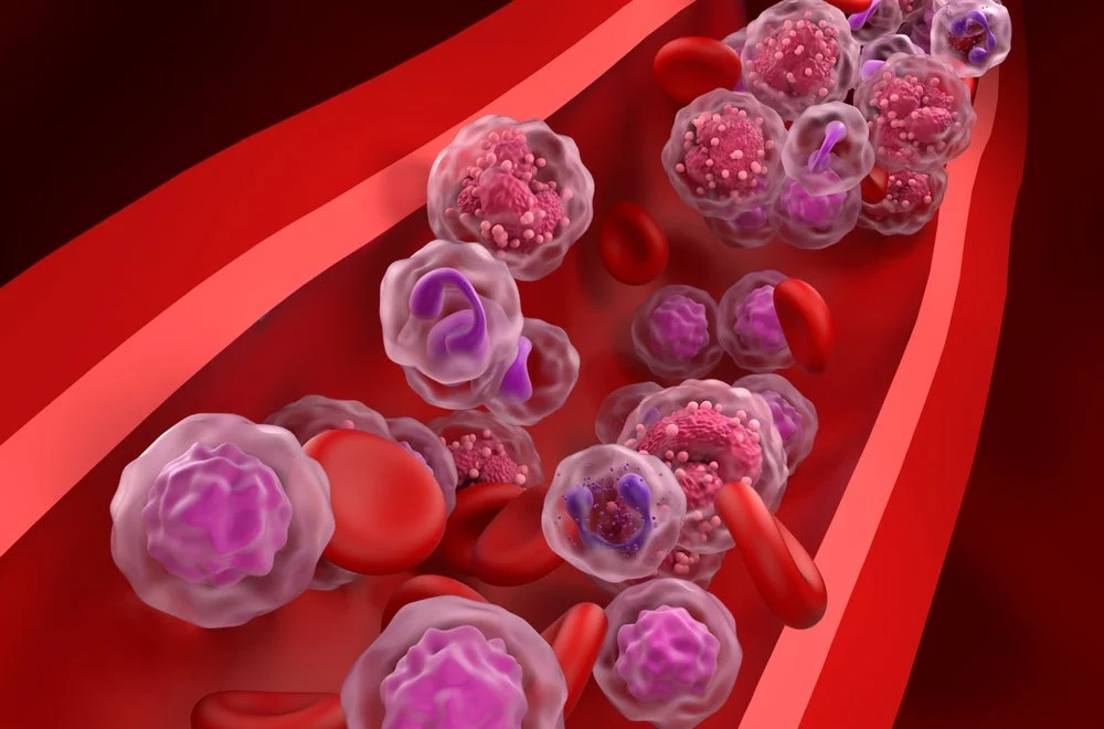 landmark-multiple-myeloma-data-unveiled-at-asco-2026-bms-and-jj-showcase-significant-advances-in-treatment-efficacy-and-accessibility