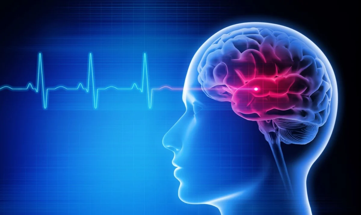 navigating-the-new-frontier-analyzing-the-2026-aha-asa-acute-ischemic-stroke-guidelines