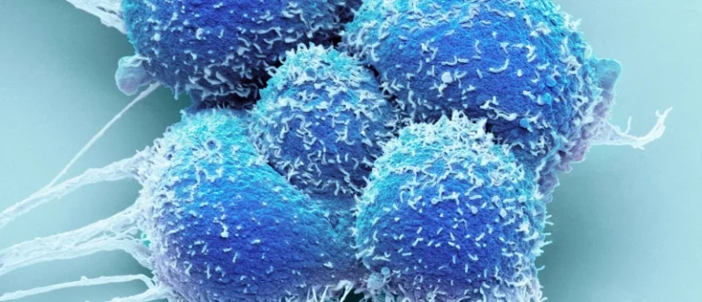 redefining-the-standard-of-care-a-deep-dive-into-the-embark-trial-and-the-evolution-of-prostate-cancer-treatment