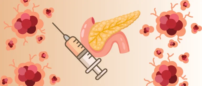 a-breakthrough-in-cancer-interception-new-kras-targeting-vaccine-shows-promise-against-pancreatic-cancer