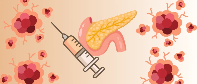 a-breakthrough-in-cancer-interception-new-kras-targeting-vaccine-shows-promise-against-pancreatic-cancer