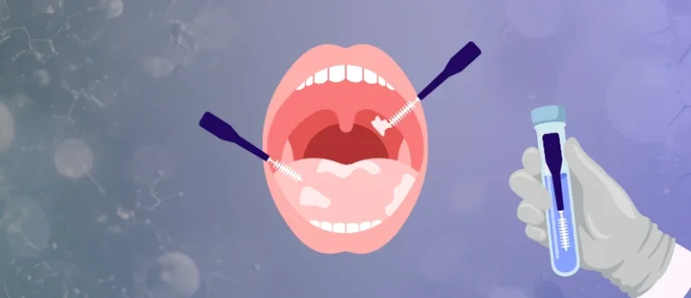 a-paradigm-shift-in-oncology-revolutionary-brush-test-promises-one-hour-oral-cancer-detection