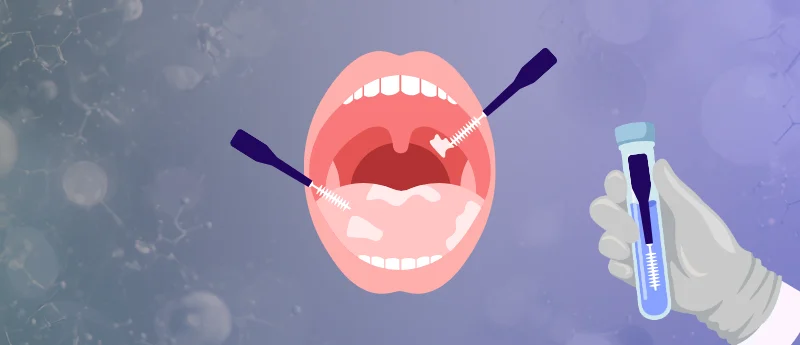 a-revolution-in-oncology-new-non-invasive-brush-test-poised-to-transform-oral-cancer-detection