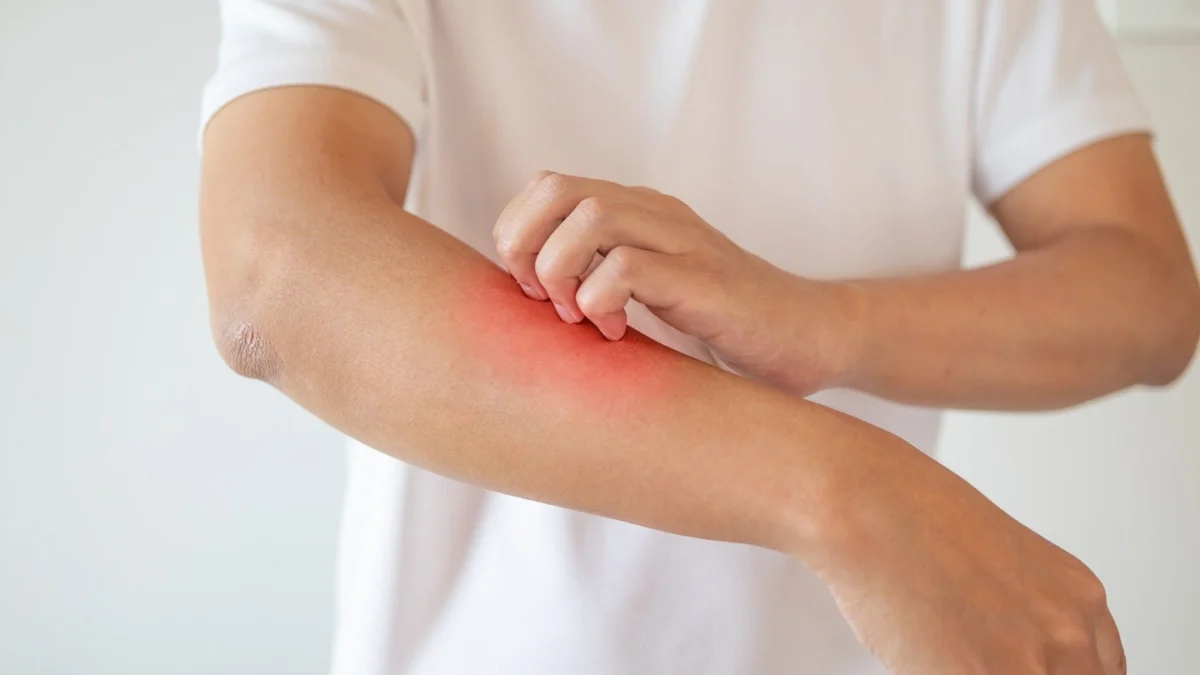 devonian-health-group-secures-health-canada-approval-for-pivotal-paediatric-atopic-dermatitis-trial-of-thykamine