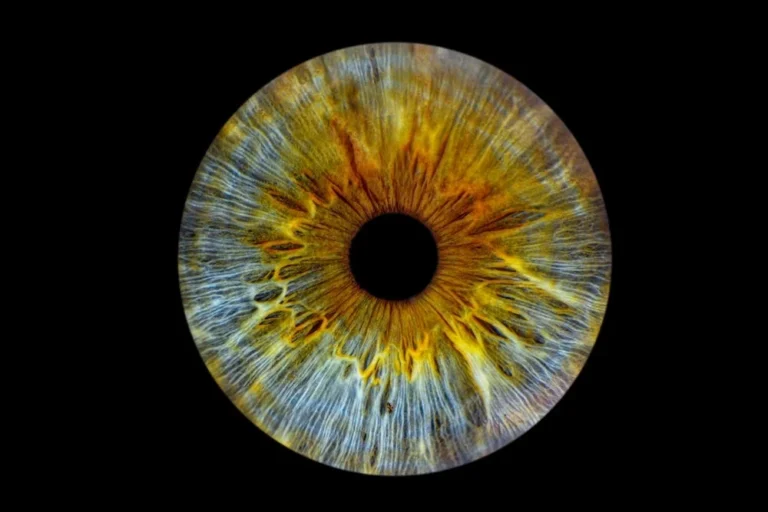 inflammasome-sets-sights-on-phase-iii-amid-eye-disease-drugs-mid-stage-score