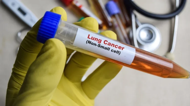 landmark-trial-initiated-for-novel-cancer-therapy-targeting-small-cell-lung-cancer