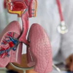 median-technologies-secures-ce-marking-for-ai-driven-lung-cancer-detection-software-eyonis-lcs