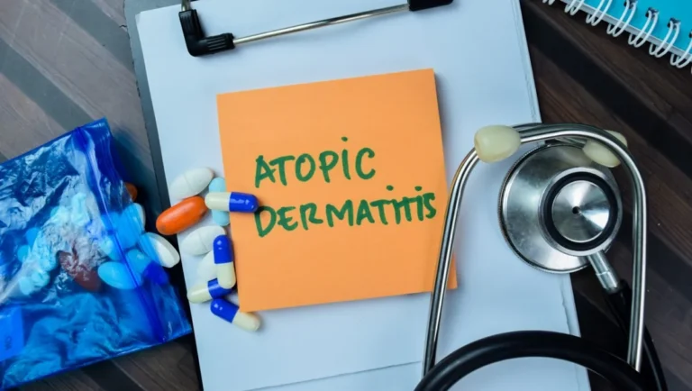 vtama-cream-demonstrates-early-and-sustained-efficacy-in-pediatric-and-adult-atopic-dermatitis-new-analysis-reveals