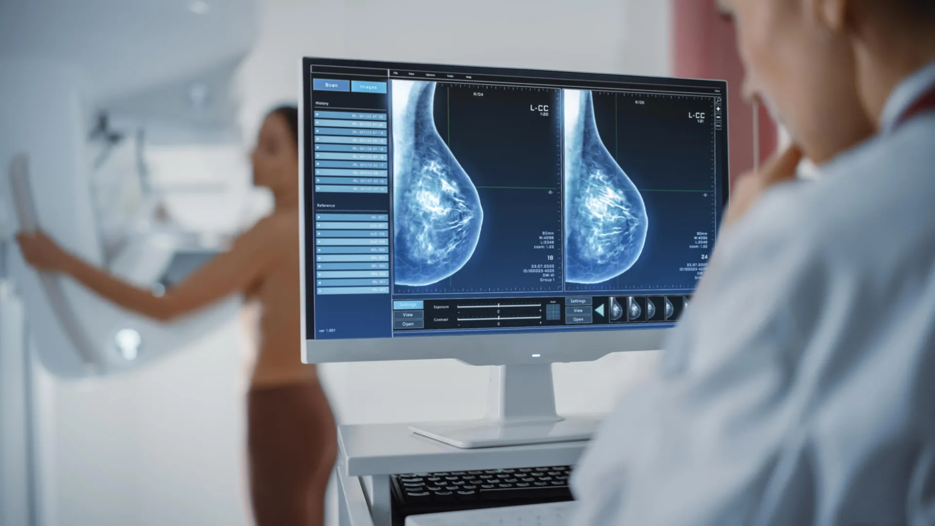 a-new-era-for-breast-cancer-screening-pioneering-personalized-risk-assessment