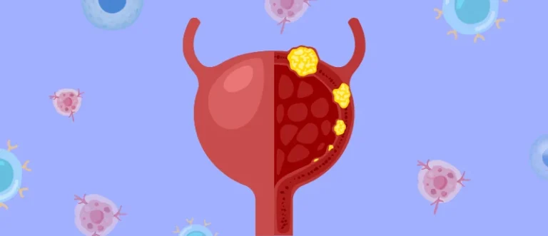 a-new-horizon-in-uro-oncology-cretostimogene-grenadenorepvec-offers-bladder-sparing-hope-for-high-risk-cancer-patients