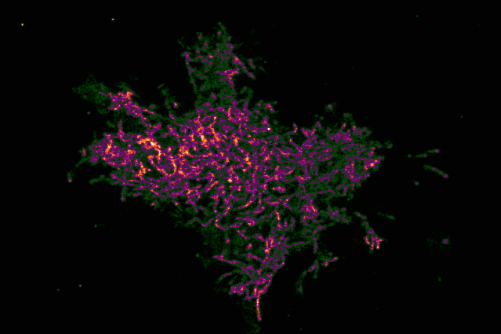 beyond-the-blur-new-imaging-breakthrough-unveils-hidden-cellular-landscapes