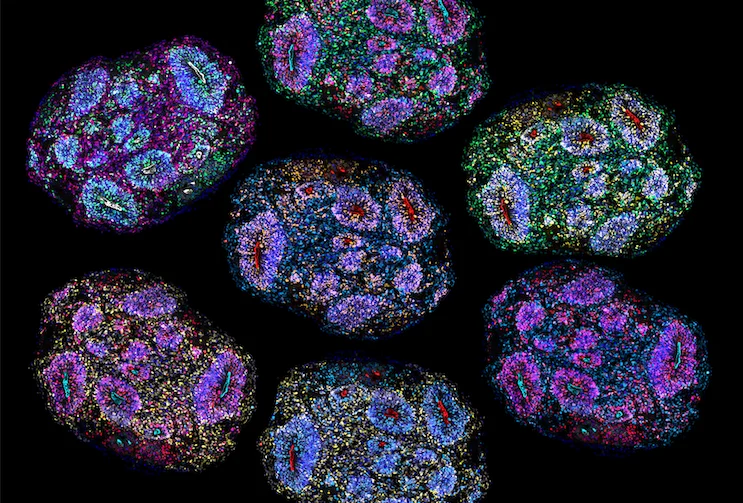 breaking-the-biological-barrier-scientists-achieve-multi-year-lifespan-for-lab-grown-brain-organoids