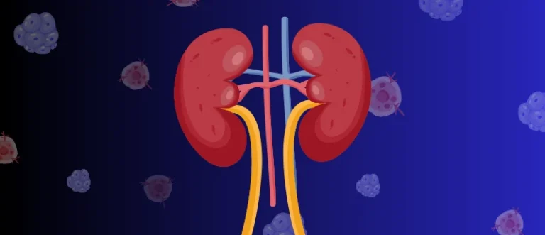 breakthrough-in-oncology-casdatifan-offers-new-hope-for-advanced-renal-cell-carcinoma