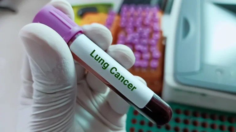 breakthrough-trial-launches-for-extensive-stage-small-cell-lung-cancer-bl-m14d1-aims-to-redefine-standard-of-care