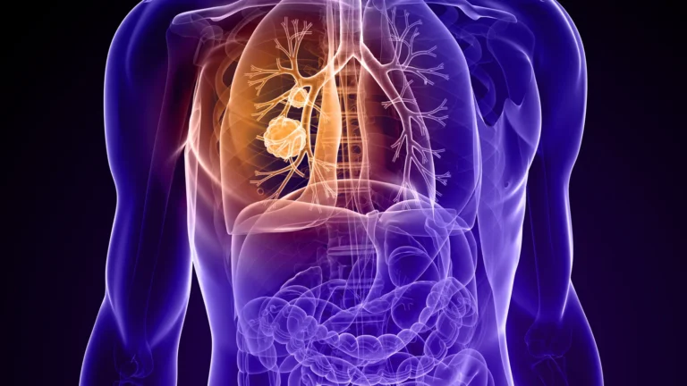 escalating-the-egfr-arms-race-the-strategic-rise-of-zipalertinib-in-lung-cancer-treatment