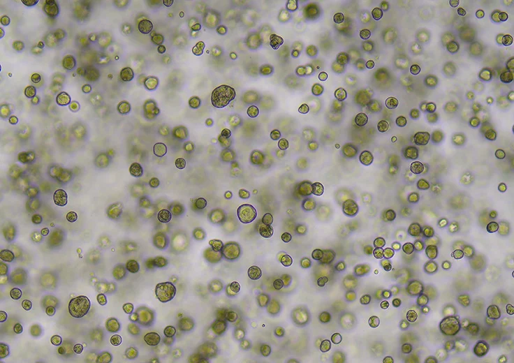 mapping-the-invisible-the-broad-institutes-depmap-revolutionizes-cancer-research-with-3d-organoid-integration