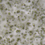mapping-the-invisible-the-evolution-of-the-cancer-dependency-map