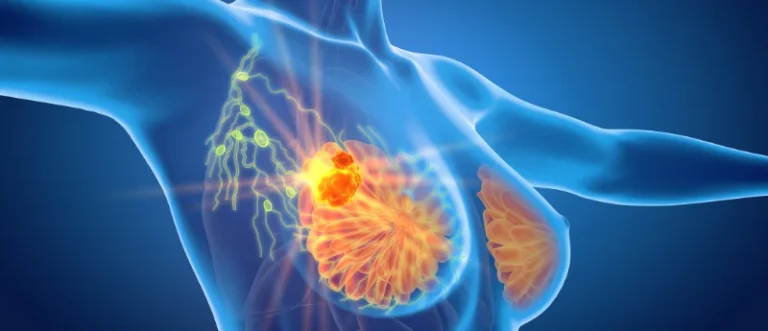 new-horizons-in-breast-cancer-care-eu-regulatory-breakthroughs-redefine-treatment-landscapes